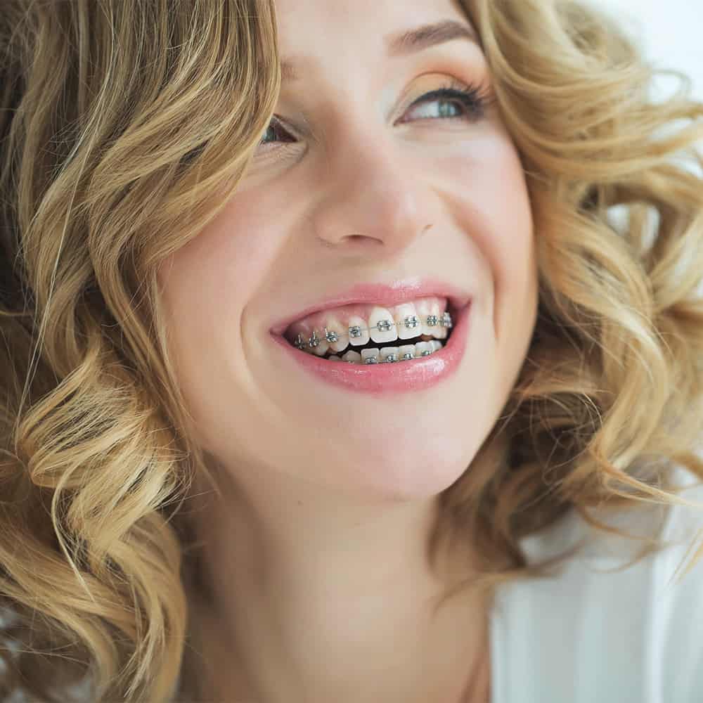 Braces for Adults in Frisco Texas